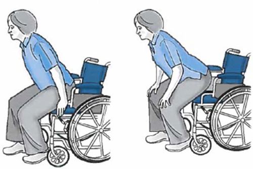 client getting up from wheelchair with hands of wheelchair and other with hands on knees